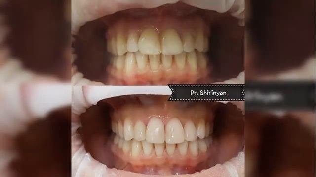 Стоматология SmileLike: фото До и После лечения зубов