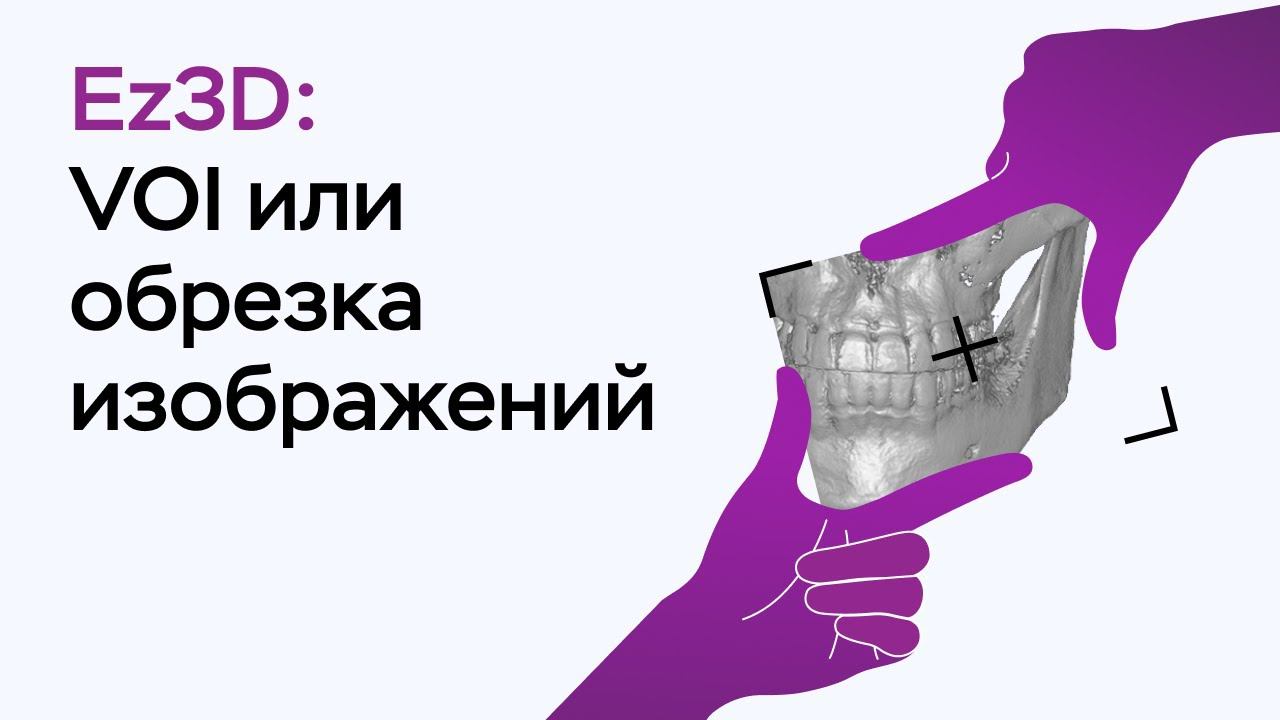 Возможности программы Ez3D: VOI или обрезка изображения