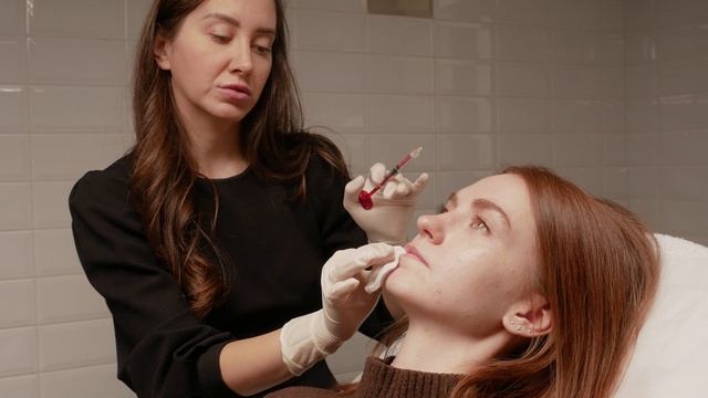 Увеличение губ филлером Neauvia lips