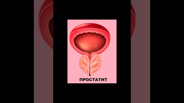МУЖСКОЕ ЗДОРОВЬЕ | ПРОБЛЕМЫ С ЭРЕКЦИЕЙ | БЕСПЛОДИЕ И ДРУГИЕ ПРОБЛЕМЫ