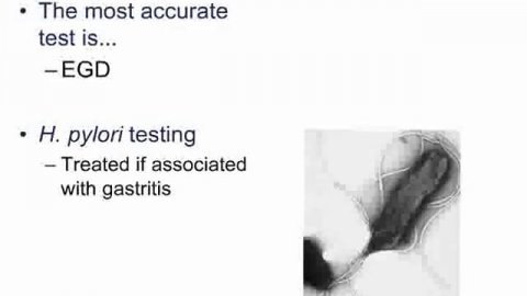 GIT RAPID REVIEW KAPLAN LECTURE | #kaplan #mbbs #medical #mtb