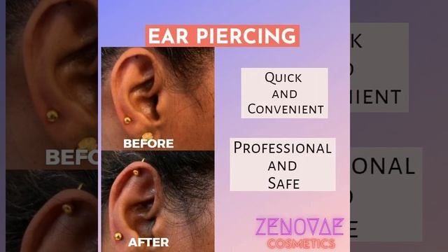 ZENOVAE  (Microblading - eyebrows, Permanent lip colour , Ear piercing, Ear piercing repair)