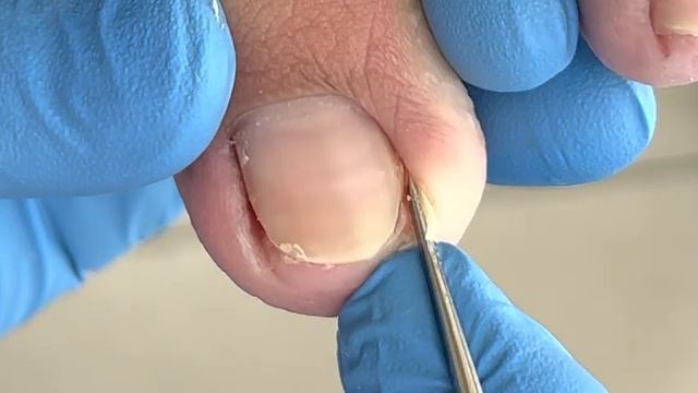 Soaked toenails, well trimmed, happy work【Xue Yidao Pedicure】
