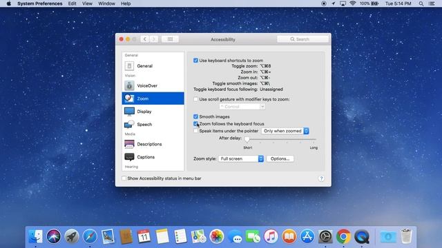 Enable Screen Zoom on MacBook