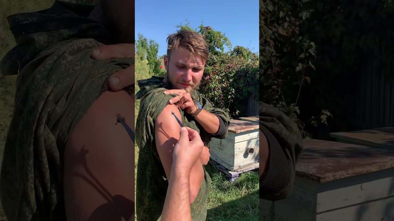 Апитерапия жалит пчела