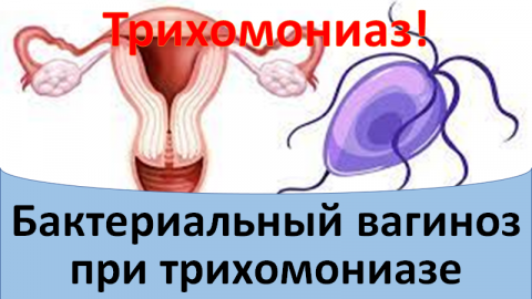 Бактериальный вагиноз при трихомониазе