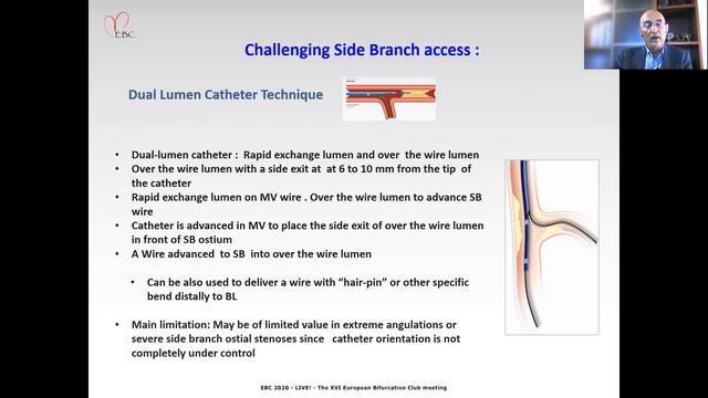 Difficult Side Branch Wiring - Prof Imad Sheiban
