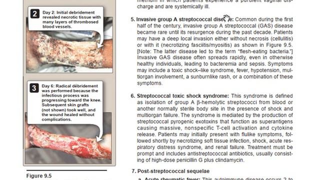 Bacteriology 4, Streptococci