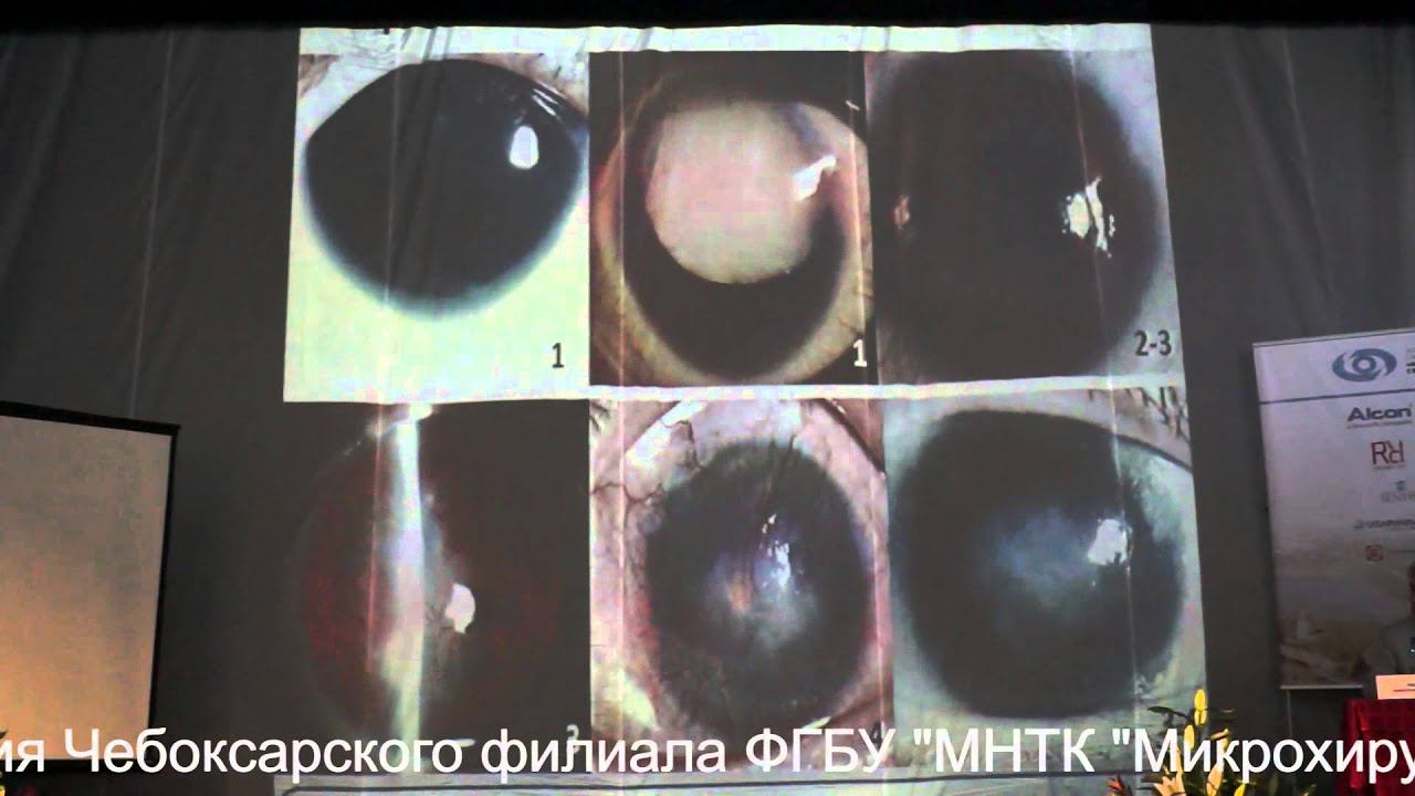 Воскресенская Анна Александровна_Чебоксары 2-3 июля 2015