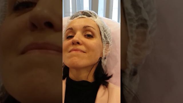 Как правильно наносить крем на лицо