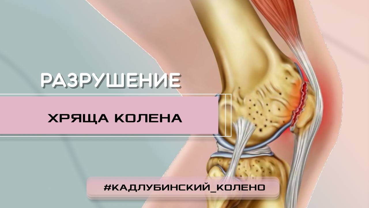Разрушение хряща колена