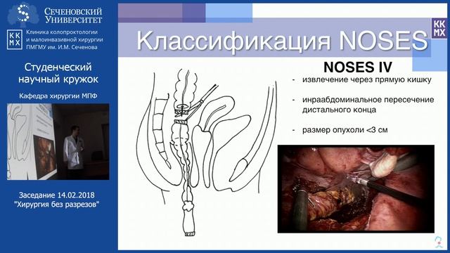 Заседание 14.02.2018. Хирургия без разрезов
