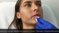 Увеличение губ. Беляева Халима