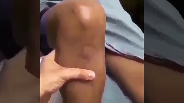 Симптом — выдвижного ящика