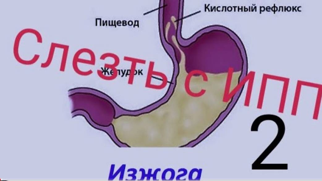 ГЭРБ. Как слезть с ИПП - 2. Минеральная вода