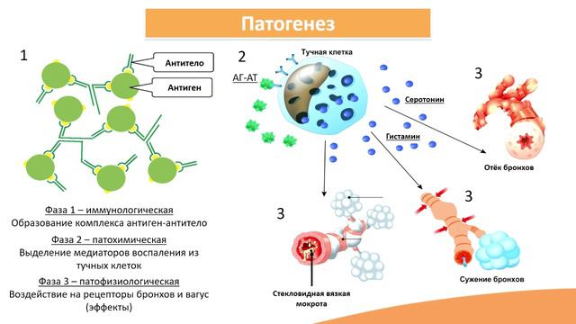 4.5. Бронхиальная астма