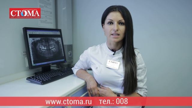СТОМА | Имплантация зубов в Санкт-Петербурге