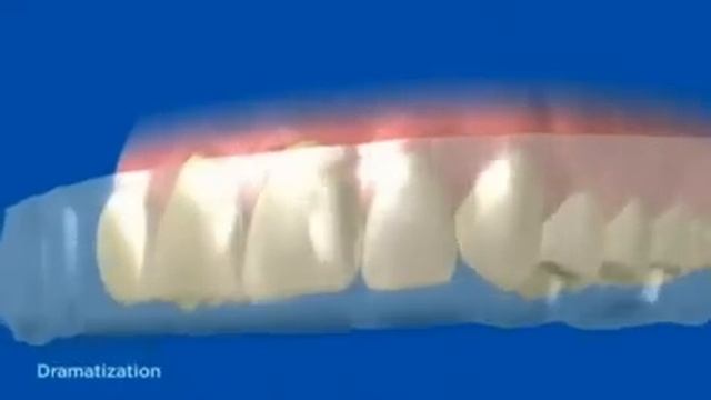 How Crest 3D Whitestrips Work