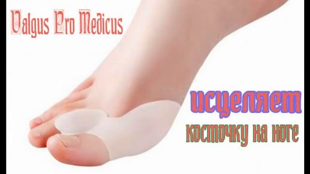 Косточка на большом пальце ноги. Valgus Pro Plus Medicus