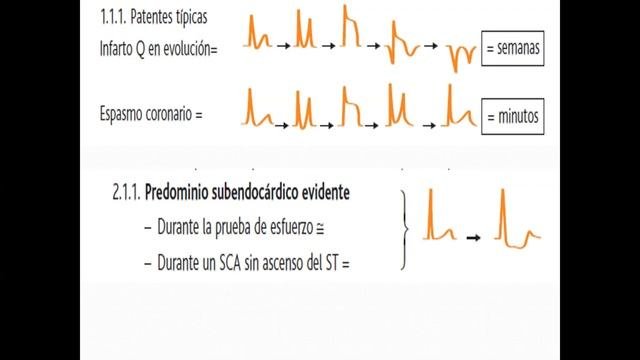 ECG en enfermedad coronaria