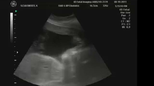 Baby Petunia.mov