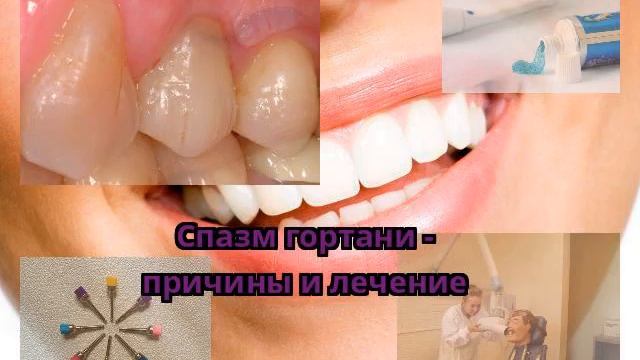 Спазм гортани - причины и лечение