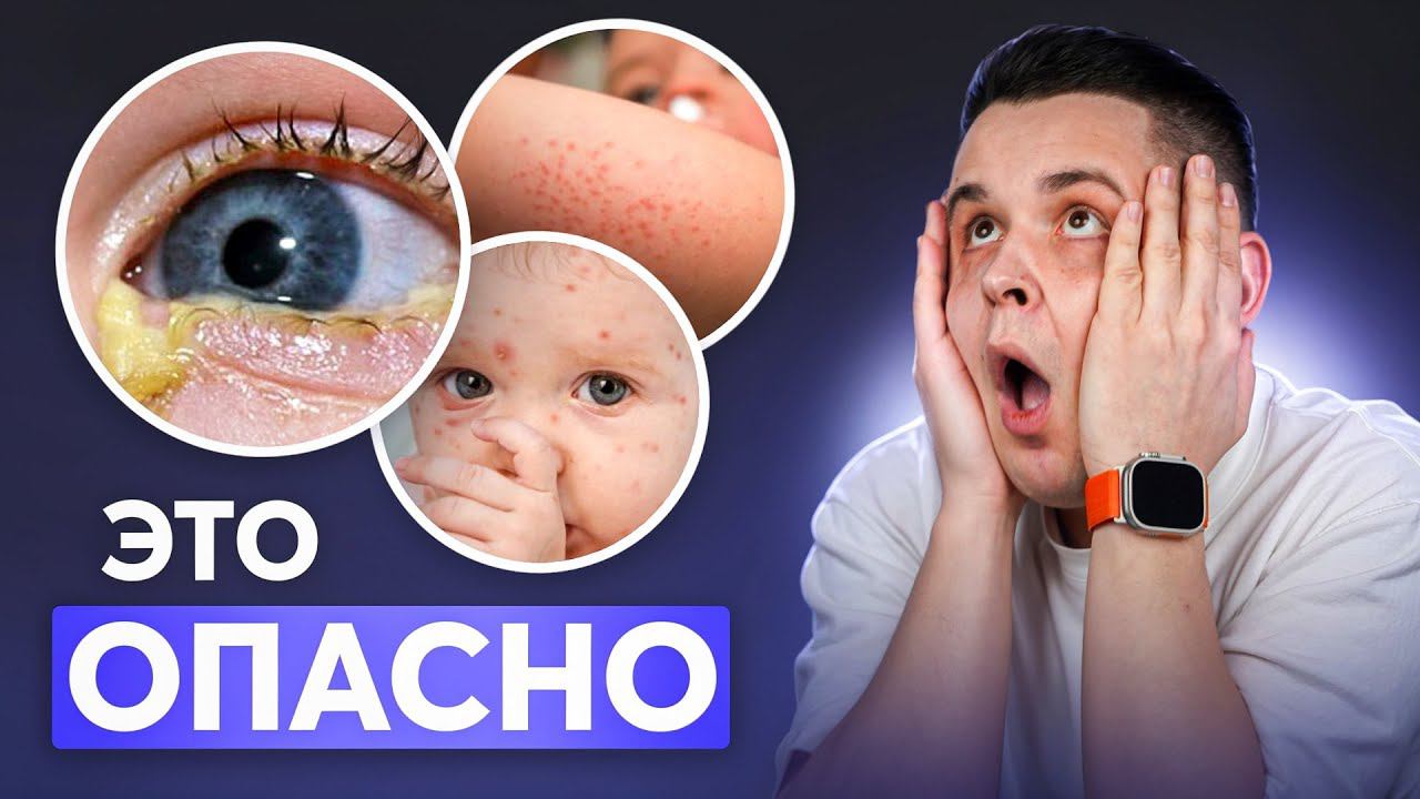 ВАЖНО ЗНАТЬ ВСЕМ! 12 Самых ОПАСНЫХ инфекций у младенцев