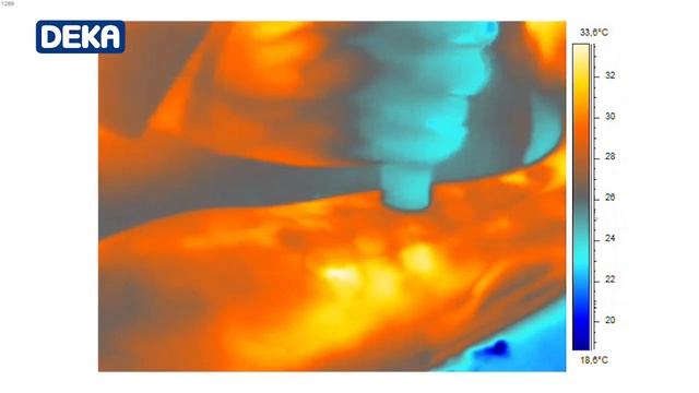 Motus AX Alexandrite Lazer   Deka Lasers   Moveo Teknolojisi  Termografik Görüntü