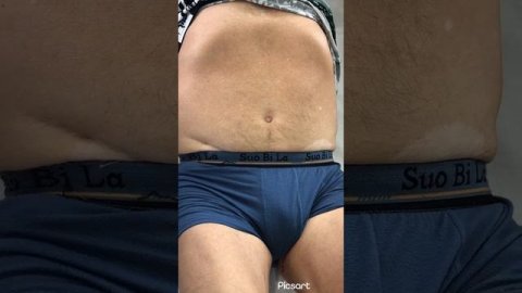 Уроки пропедевтики (пальпация и аускультация брюшной аорты и ее ветвей) #лекции