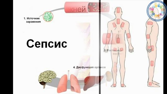 9. Пролежни: причины,профилактика, лечение