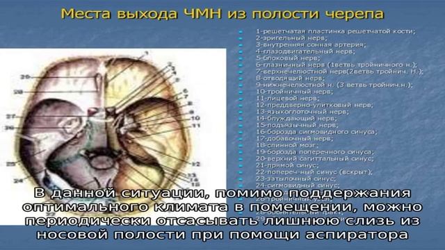 Симптомы и лечение обильных соплей у ребенка