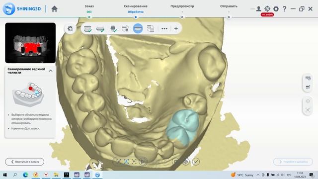 EXOCAD: БЕСПЛАТНЫЙ КУРС | УРОК 3: СКАНИРОВАНИЕ. ПЕРВЫЙ ВЗГЛЯД НА CAD