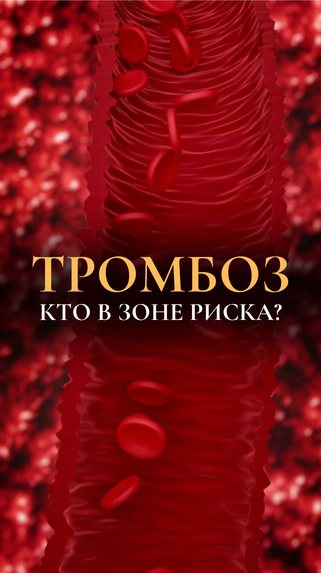 Тромбоз: кто в зоне риска?