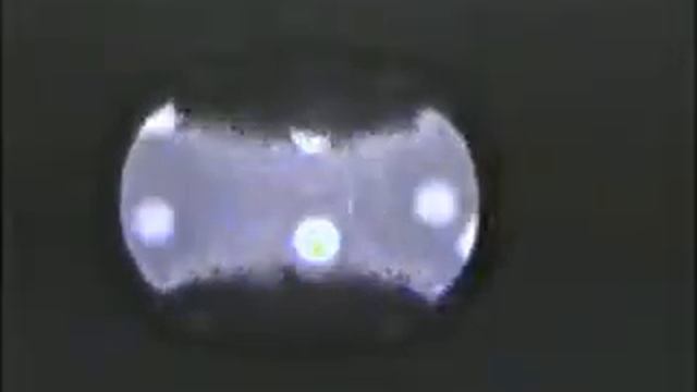 рис  5  миопический астигматизм