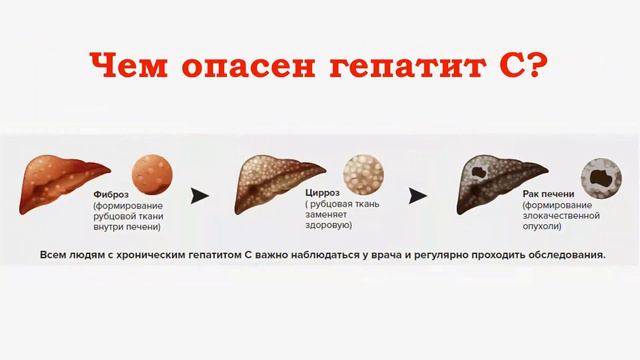 Профилактика Гепатита С