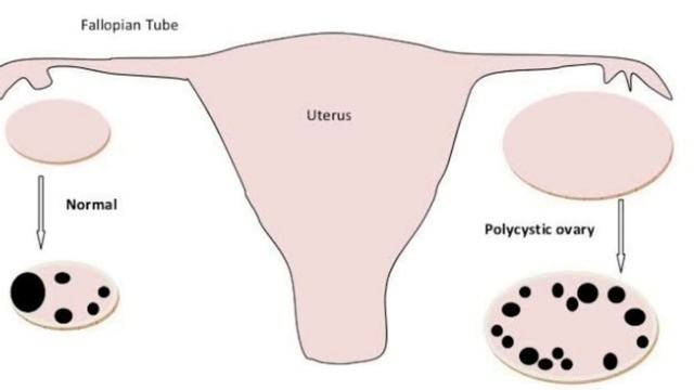 Follicular  monitoring /Ovulation study /Follicle/Doctor  home/