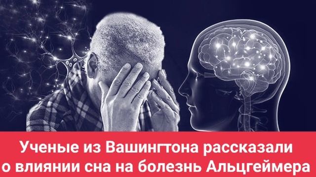 Ученые из Вашингтона рассказали о влиянии сна на болезнь Альцгеймера