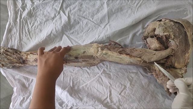 Triceps Brachii Muscle II Dissection II Demonstrationi