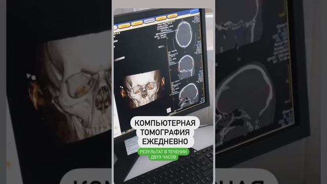 Компьютерная томография ежедневно в МК Новый Век
