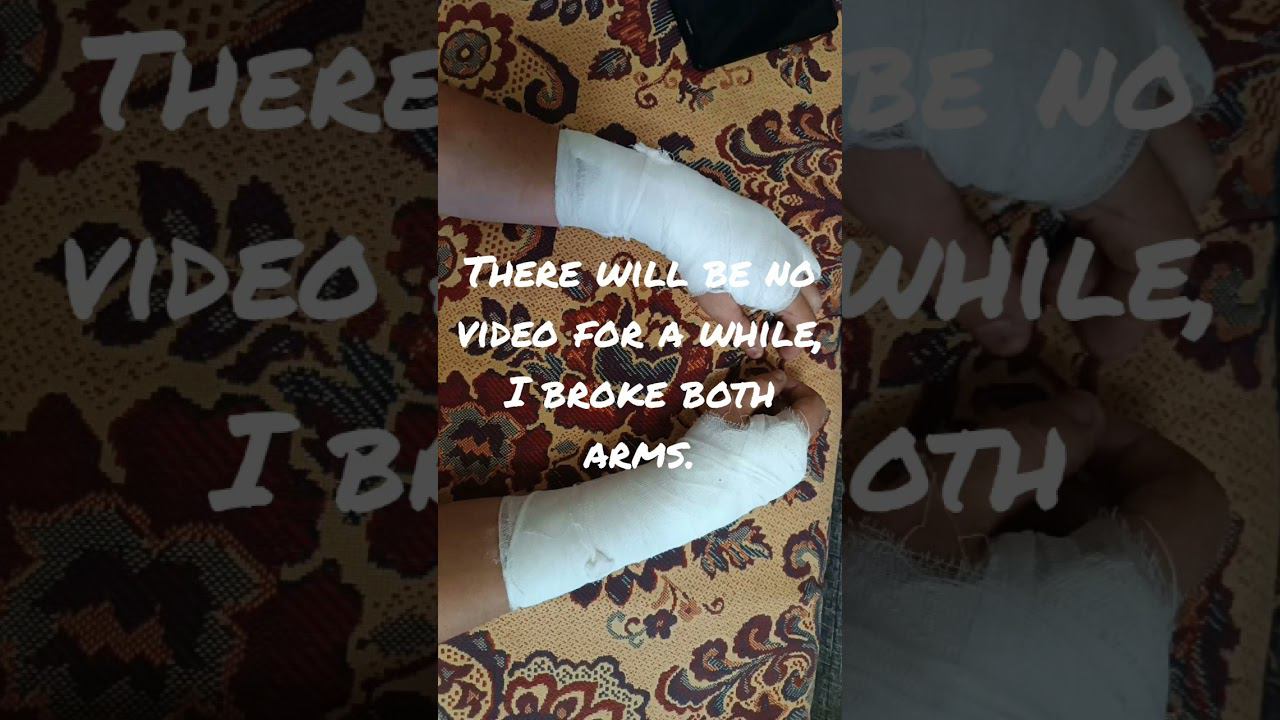 There will be no video for a while, I broke both arms. #my_music #rock #nu_metal #metal