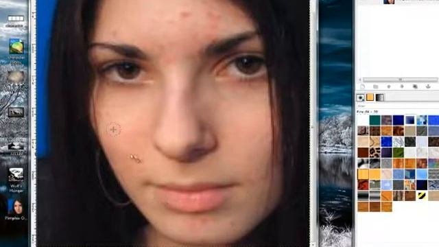 Removings Zits Gimp Tutorial