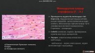 Миокардтың қоңыр атрофиясы (Г.-Э.)