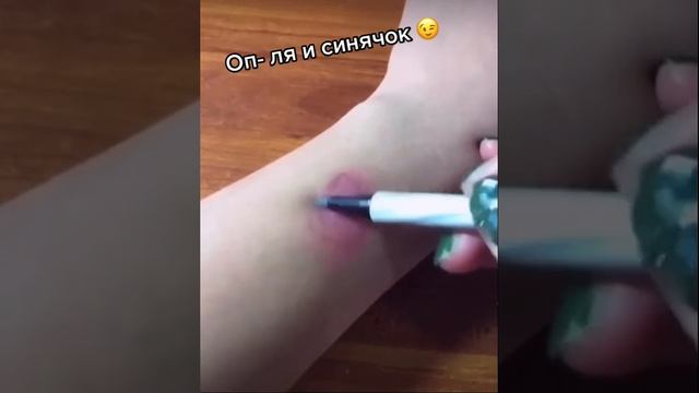 Синячок