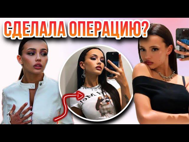 Валя Карнавал СДЕЛАЛА ПЛАСТИКУ? Когда и почему ОБ ЭТОМ все говорят?