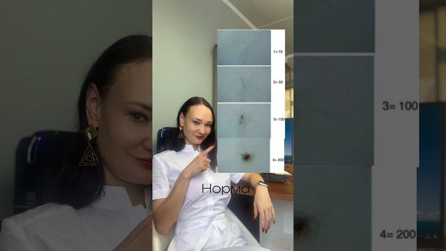 Как определить в норме ли выпадение волос?