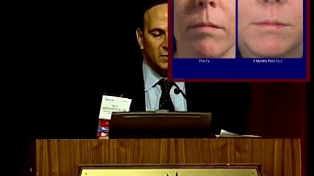 Fractional Deep Dermal Ablation Laser Resurfacing