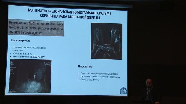 Мазо М.Л. — Комплексный подход в ранней диагностике заболеваний молочных желез