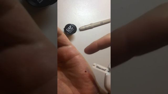 Кровь на сахар из ладони (зона гипотенар)