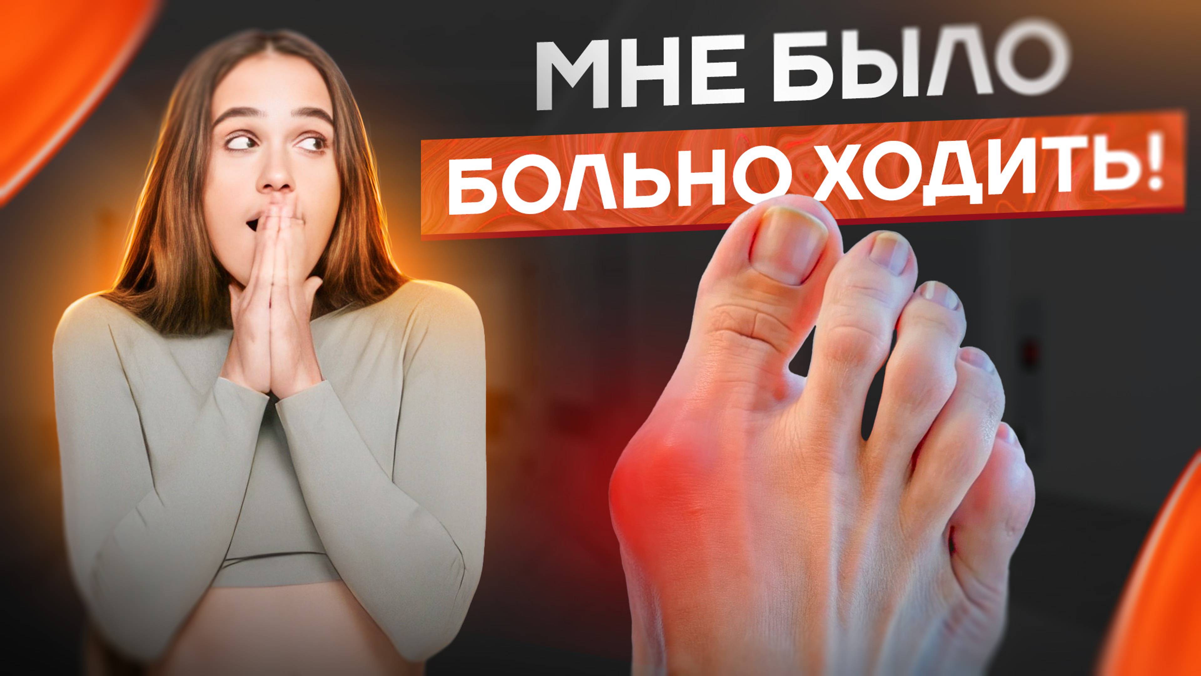 Как я ВЫЛЕЧИЛА КОСТОЧКУ на большом пальце | 4 простых способа от ОСТЕОПАТА