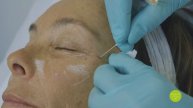 Aliaxin FullFace Treatment Dr Salti